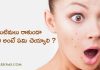 మొటిమలు రాకుండా ఉండాలి అంటే ఏమి చెయ్యాలి ? | How To Avoid Pimples in Telugu