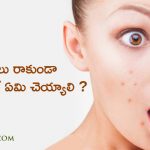 what-should-be-getting-pimples