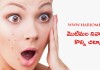 మొటిమల నివారణకు కొన్ని చిట్కాలు | Tips to Prevent Pimples in Telugu