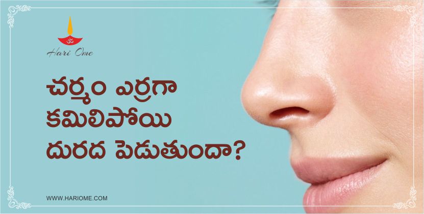 Tips to reduce red skin itching