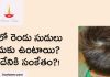 తలలో రెండు సుడులు ఉండటానికి గల శాస్త్రీయ కారణం! | Whorls In Head Whorls In Head
