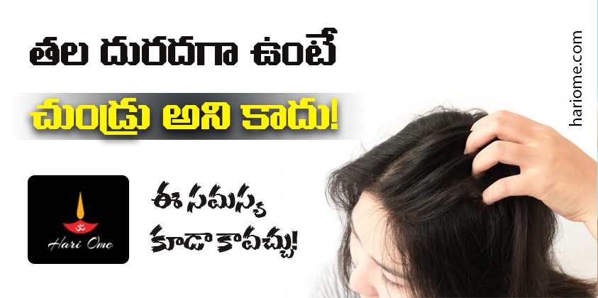 Get Rid of Dandruff