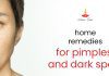 Home Remedies To Remove pimples and dark spots on the Face Natural Remedies To Get Rid Of Dark Spots And Pimples