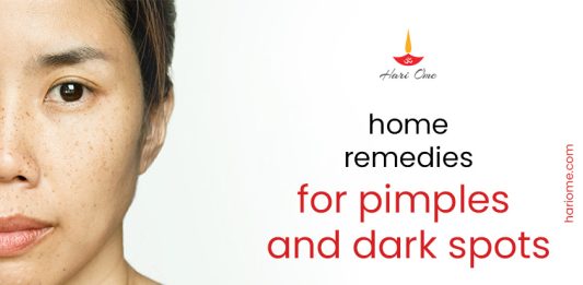 Natural Remedies To Get Rid Of Dark Spots And Pimples